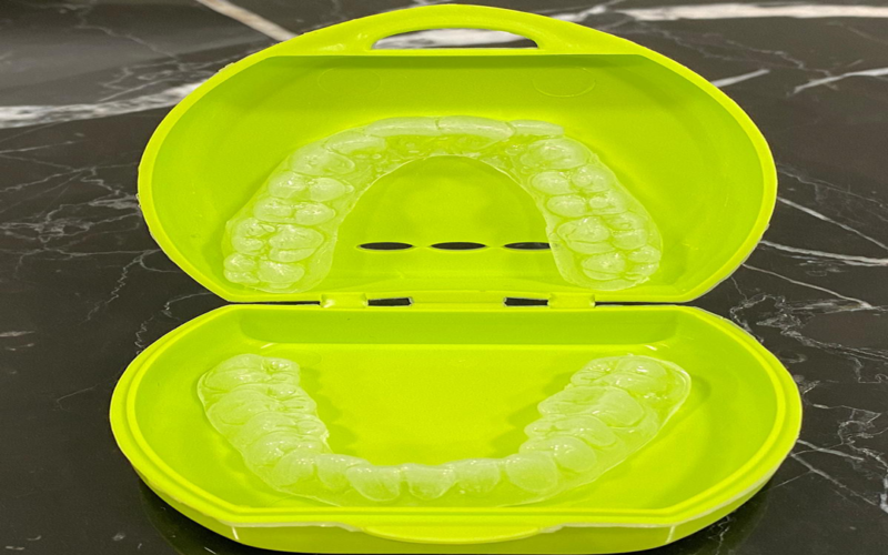 Gum Shield Dental Treatment in Turkey