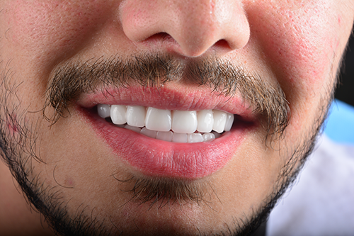 Dental Travel Turkey Zirconium Crown